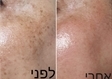 מכון יופי בירושלים