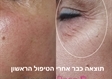 מכון יופי בירושלים