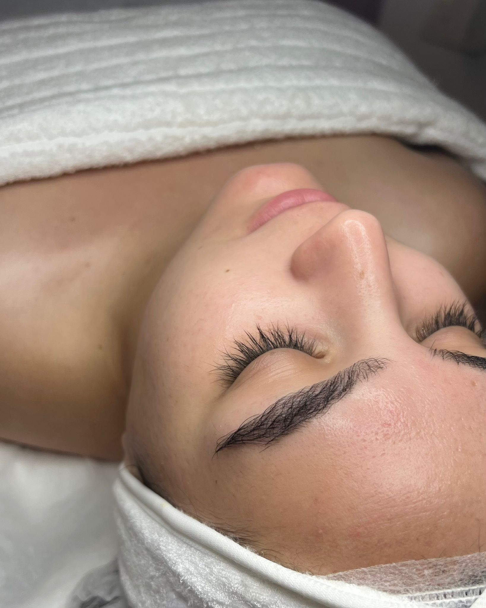 טיפולי פנים במעלה אדומים