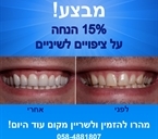 מבצע 15% הנחה לציפויים לשניים